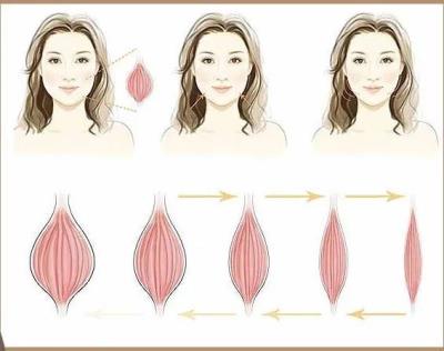 瘦脸针这么打，视觉让你长高10公分！